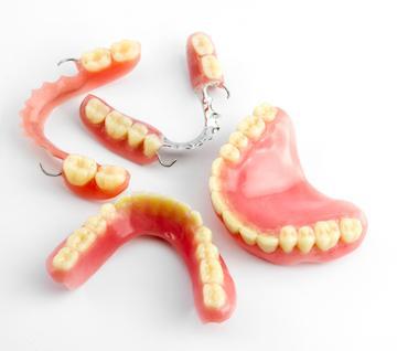 Several sets of dentures | Dentist in Orlando FL
